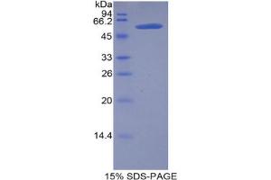SDS-PAGE analysis of Mouse Lipase, Hepatic Protein.