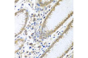 Immunohistochemistry of paraffin-embedded human stomach using EIF4E antibody at dilution of 1:100 (40x lens). (EIF4E Antikörper)
