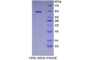 SDS-PAGE analysis of Human IL12Rb2 Protein. (IL12RB2 Protein)