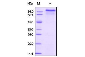 Biotinylated Human ErbB3 on SDS-PAGE under reducing (R) condition. (ERBB3 Protein (AA 20-643) (His tag,Biotin))