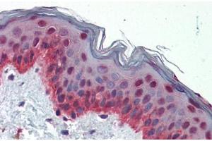 Human Skin (formalin-fixed, paraffin-embedded) stained with NFIX antibody ABIN462183 followed by biotinylated goat anti-rabbit IgG secondary antibody ABIN481713, alkaline phosphatase-streptavidin and chromogen. (NFIX Antikörper  (AA 181-230))