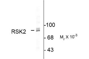 Western blots of HeLa lysate showing specific immunolabeling of the ~90k RSK2 protein. (RPS6KA2 Antikörper  (C-Term))