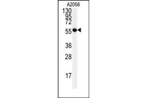 Image no. 1 for anti-Heat Shock 60kDa Protein 1 (Chaperonin) (HSPD1) (Center) antibody (ABIN358040) (HSPD1 Antikörper  (Center))