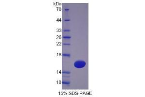 Image no. 1 for Tetraspanin 1 (TSPAN1) (AA 112-215) protein (His tag) (ABIN4990423)