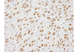 Immunohistochemistry (IHC) image for anti-Structural Maintenance of Chromosomes 1A (SMC1A) (C-Term) antibody (ABIN7448802)