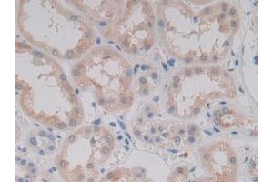 Immunohistochemistry (IHC) image for anti-Procollagen C-Endopeptidase Enhancer 2 (PCOLCE2) (AA 297-415) antibody (ABIN7438220)