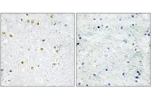 Immunohistochemistry analysis of paraffin-embedded human brain tissue, using TRIM24 Antibody. (TRIM24 Antikörper  (AA 1001-1050))