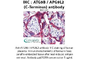 Image no. 1 for anti-Autophagy Related 9B (ATG9B) (C-Term) antibody (ABIN1732024) (ATG9B Antikörper  (C-Term))