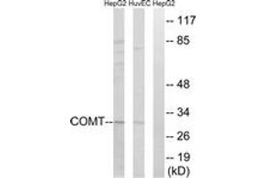 Western blot analysis of extracts from HuvEc/HepG2 cells, using COMT Antibody. (COMT Antikörper  (AA 61-110))