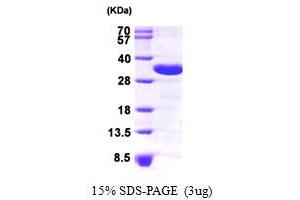 SDS-PAGE (SDS) image for Charged Multivesicular Body Protein 2A (CHMP2A) (AA 1-222) protein (His tag) (ABIN667746) (CHMP2A Protein (AA 1-222) (His tag))