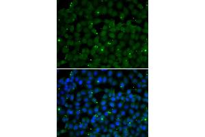 Immunofluorescence analysis of U2OS cells using GPI antibody (ABIN6292114).