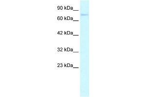 WB Suggested Anti-ZNF336 Antibody Titration: 0. (ZNF336 Antikörper  (N-Term))