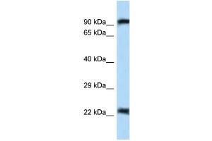 Western Blotting (WB) image for anti-Ubiquitin-Like with PHD and Ring Finger Domains 2, E3 Ubiquitin Protein Ligase (UHRF2) (N-Term) antibody (ABIN2776011)