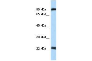 WB Suggested Anti-Uhrf2 Antibody Titration: 1.