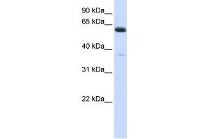 WB Suggested Anti-ALG6 Antibody Titration:  0. (ALG6 Antikörper  (N-Term))