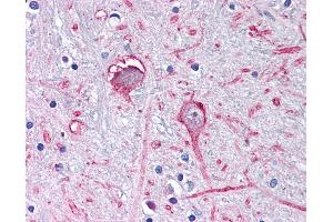 Anti-GABRA3 antibody IHC of human brain, globus pallidus. (GABRA3 Antikörper  (C-Term))