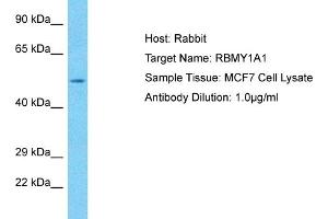 Host: Rabbit Target Name: RBMY1A1 Sample Tissue: Human MCF7 Whole Cell Antibody Dilution: 1ug/ml (RBMY1A1 Antikörper  (C-Term))