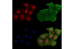 ABIN6256993 and ABIN6274555 staining Hela cells by IF/ICC. (YBX2 Antikörper  (C-Term))