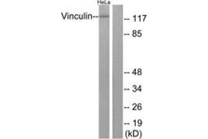 Western blot analysis of extracts from HeLa cells, treated with forskolin 40nM 30', using Vinculin (Ab-821) Antibody. (Vinculin Antikörper  (AA 786-835))