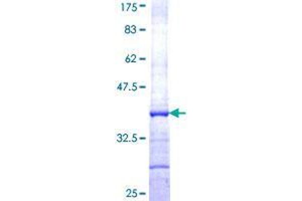 ADH1A Protein (AA 298-375) (GST tag)