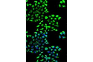 Immunofluorescence analysis of MCF7 cells using COPS6 antibody (ABIN6130710, ABIN6138885, ABIN6138886 and ABIN6222868). (COPS6 Antikörper  (AA 58-327))