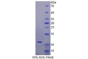 SDS-PAGE analysis of Human S100A15 Protein.