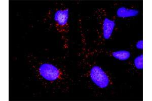 Proximity Ligation Analysis of protein-protein interactions between KLK3 and A2M. (Prostate Specific Antigen Antikörper  (AA 1-261))