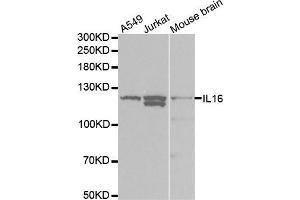 Western blot analysis of extracts of various cell lines, using IL16 antibody. (IL16 Antikörper  (AA 1-305))