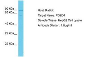 Image no. 1 for anti-PDZ Domain Containing 4 (PDZD4) (AA 536-585) antibody (ABIN6750650) (PDZD4 Antikörper  (AA 536-585))