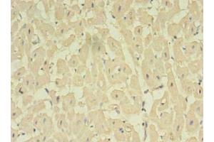 Immunohistochemistry of paraffin-embedded human heart tissue using ABIN7161713 at dilution of 1:100