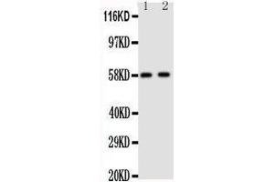 Anti-Aromatase antibody, Western blotting Lane 1: Human Placenta Tissue Lysate Lane 2: Human Placenta Tissue Lysate (Aromatase Antikörper  (C-Term))
