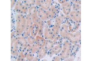 IHC-P analysis of Rat Tissue, with DAB staining. (CUBN Antikörper  (AA 3157-3274))