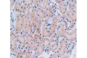 IHC-P analysis of Rat Tissue, with DAB staining. (CUBN Antikörper  (AA 3157-3274))