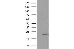 HEK293T cells were transfected with the pCMV6-ENTRY control (Left lane) or pCMV6-ENTRY PDF (Right lane) cDNA for 48 hrs and lysed. (GDF15 Antikörper)