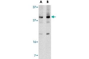 Western blot analysis of Klra2 in mouse spleen tissue lysate with Klra2 polyclonal antibody  at (A) 0. (Klra2 Antikörper  (C-Term))