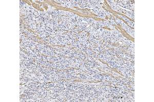 IHC analysis of MT-ND5 using anti-MT-ND5 antibody (ABIN7600145). (MT-ND5 Antikörper  (AA 154-570))