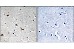 Immunohistochemistry analysis of paraffin-embedded human brain, using IKK-gamma (Phospho-Ser376) Antibody. (IKBKG Antikörper  (pSer376))