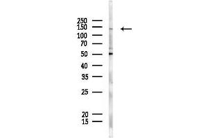 anti-ATP-Binding Cassette, Sub-Family B (MDR/TAP), Member 1 (ABCB1) (Internal Region) antibody