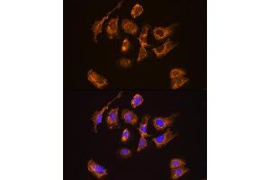Immunofluorescence analysis of U2OS cells using TRH Rabbit pAb (ABIN7270826) at dilution of 1:100. (TRH Antikörper  (AA 100-200))