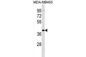 Western Blotting (WB) image for anti-Vomeronasal 1 Receptor 2 (VN1R2) antibody (ABIN3000165) (VN1R2 Antikörper)