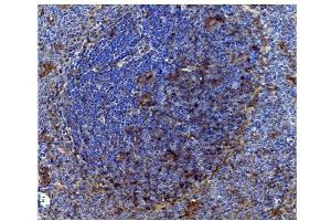 IHC analysis of CD82 using anti-CD82 antibody (ABIN7601301). (CD82 Antikörper  (AA 32-266))