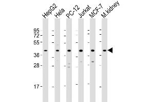 Western Blot at 1:2000 dilution Lane 1: HepG2 whole cell lysate Lane 2: Hela whole cell lysate Lane 3: PC-12 whole cell lysate Lane 4: Jurkat whole cell lysate Lane 5: MCF-7 whole cell lysate Lane 6: mouse kidney lysate Lysates/proteins at 20 ug per lane.