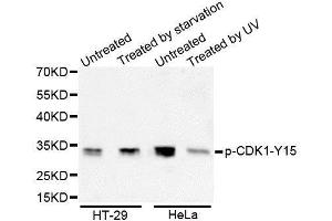 Western Blotting (WB) image for anti-Cyclin-Dependent Kinase 1 (CDK1) (pTyr15) antibody (ABIN6225371) (CDK1 Antikörper  (pTyr15))