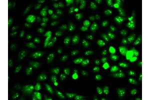 Immunofluorescence analysis of HeLa cell using IDH1 antibody. (IDH1 Antikörper  (AA 1-414))