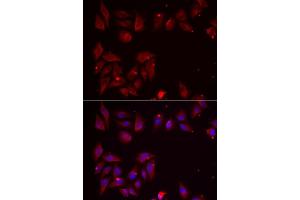 Immunofluorescence analysis of U2OS cells using PDXK antibody. (PDXK Antikörper  (AA 1-312))