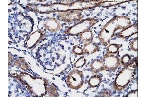 Image no. 2 for anti-Four and A Half LIM Domains 1 (FHL1) (AA 207-256) antibody (ABIN202152)