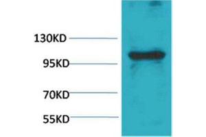 Western Blot (WB) analysis of Pig Skeletal Muscle with eEF1A2 Rabbit Polyclonal Antibody diluted at 1:1,000. (IGFN1 Antikörper)