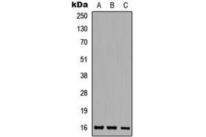 Western blot analysis of Ataxin 7L1 expression in HeLa (A), Raw264. (ATXN7L1 Antikörper  (Center))