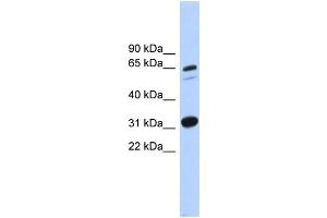 WB Suggested Anti-ITFG3 Antibody Titration: 0.