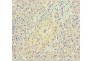 Immunohistochemistry of paraffin-embedded human pancreatic tissue using ABIN7165325 at dilution of 1:100 (LMAN1L Antikörper  (AA 26-462))